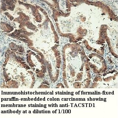 TACSTD1 Antibody