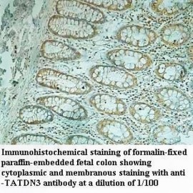 TATDN3 Antibody