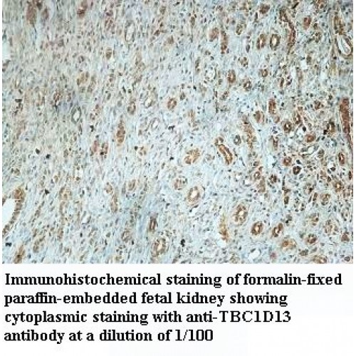 TBC1D13 Antibody
