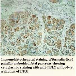 TBL2 Antibody