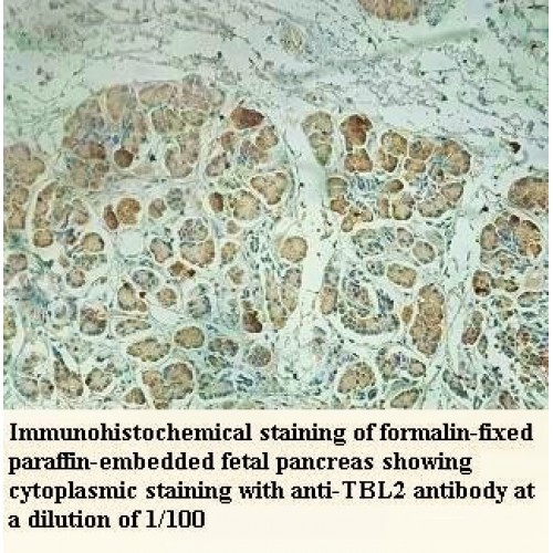 TBL2 Antibody