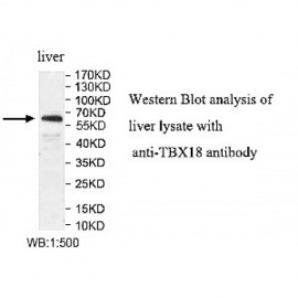 TBX18 Antibody