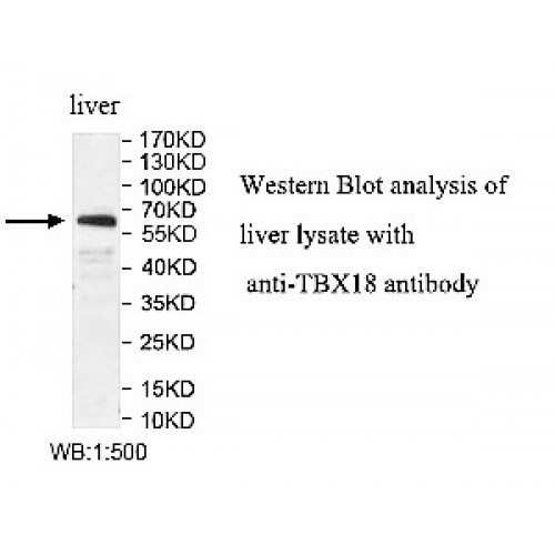 TBX18 Antibody