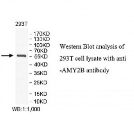 AMY2B Antibody