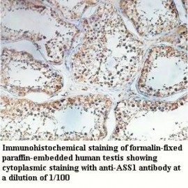 ASS1 Antibody
