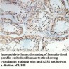 ASS1 Antibody