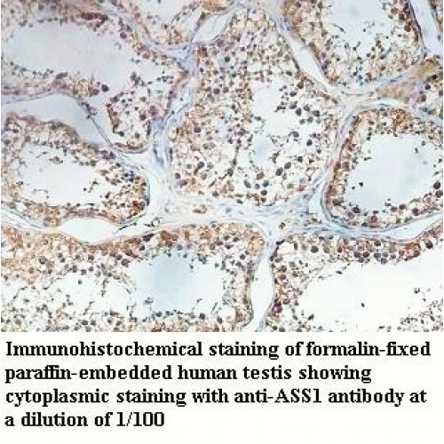 ASS1 Antibody
