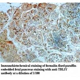 TBL1Y Antibody