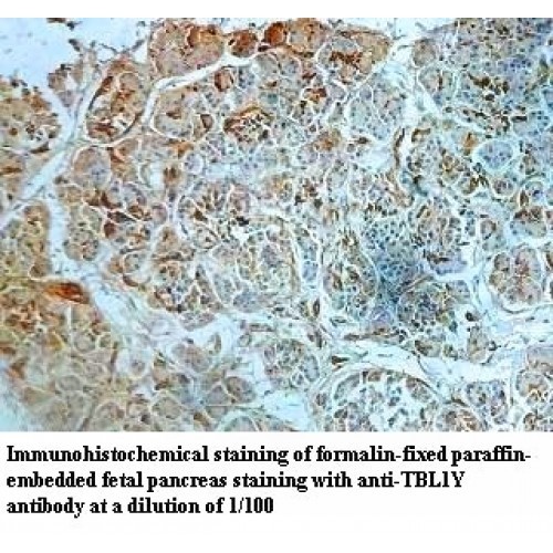TBL1Y Antibody