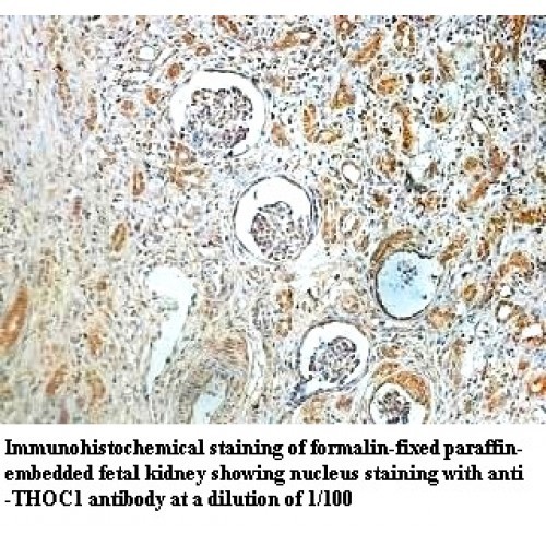 THOC1 Antibody