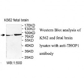 THOP1 Antibody