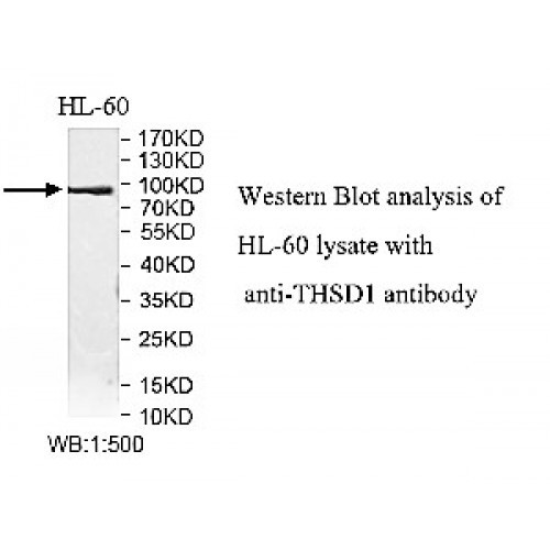 THSD1 Antibody