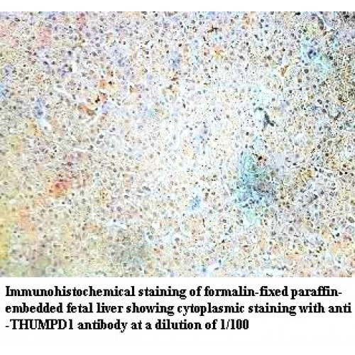 THUMPD1 Antibody