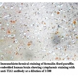 TIA1 Antibody