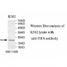 TIFA Antibody