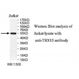 TBX15 Antibody