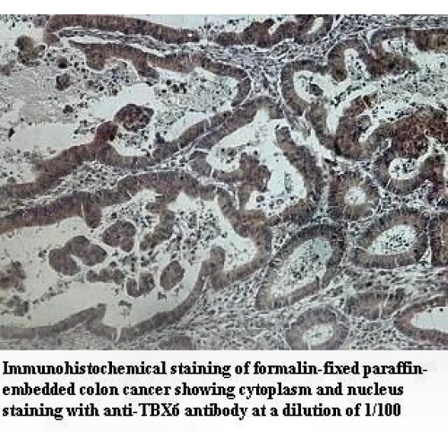 TBX6 Antibody