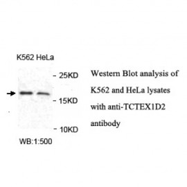 TCTEX1D2 Antibody