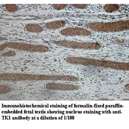 TK1 Antibody