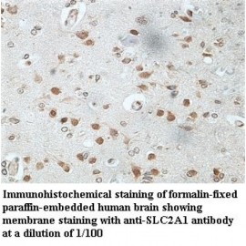SLC9A1 Antibody