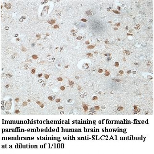 SLC9A1 Antibody