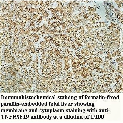 TNFRSF19 Antibody