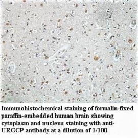 URGCP Antibody