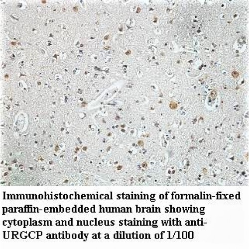 URGCP Antibody