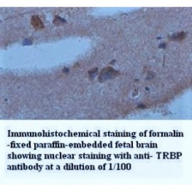 TRBP Antibody