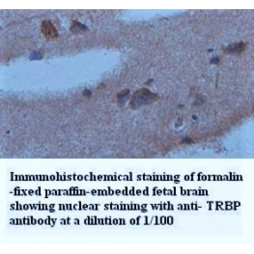 TRBP Antibody