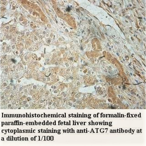 ATG7 Antibody