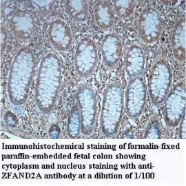 ZFAND2A Antibody
