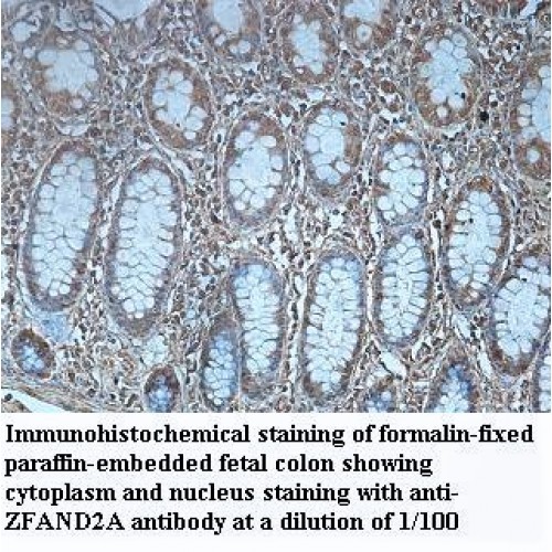ZFAND2A Antibody