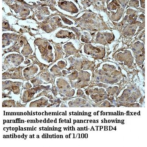ATPBD4 Antibody