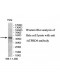 ATPBD4 Antibody
