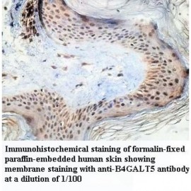 B4GALT5 Antibody