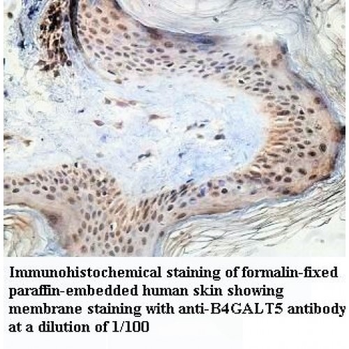 B4GALT5 Antibody