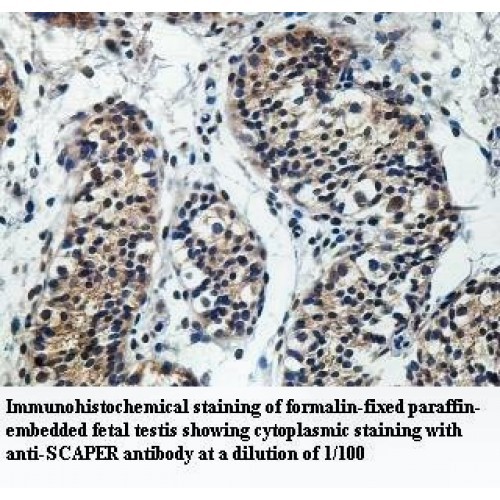 SCAPER Antibody