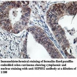 SEPHS2 Antibody
