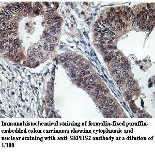 SEPHS2 Antibody