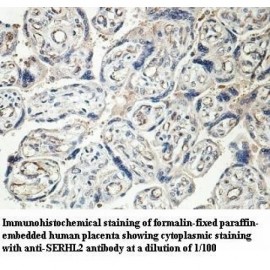 SERHL2 Antibody