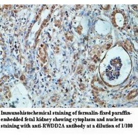 RWDD2A Antibody
