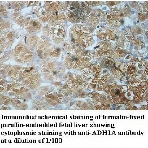 ADH1A Antibody