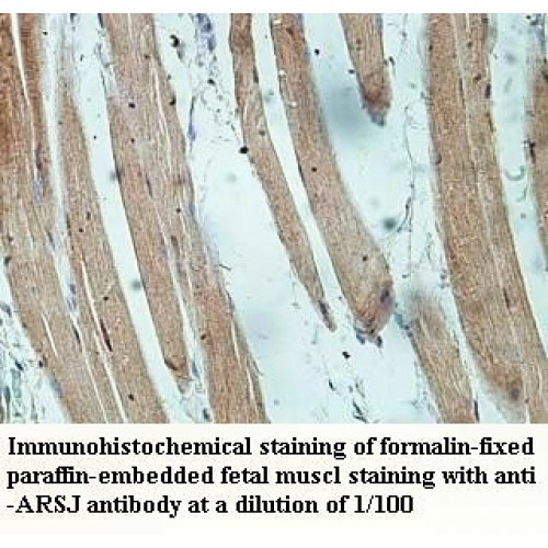 ARSJ Antibody