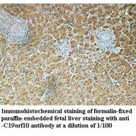c19orf10 Antibody
