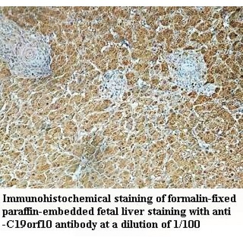 c19orf10 Antibody