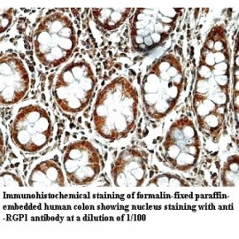 RGP1 Antibody