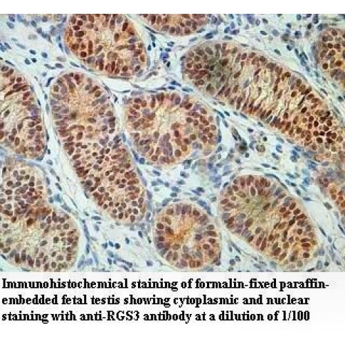 RGS3 Antibody