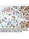 RHOBTB1 Antibody