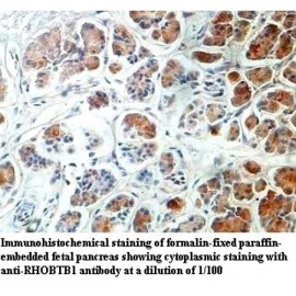RHOBTB1 Antibody
